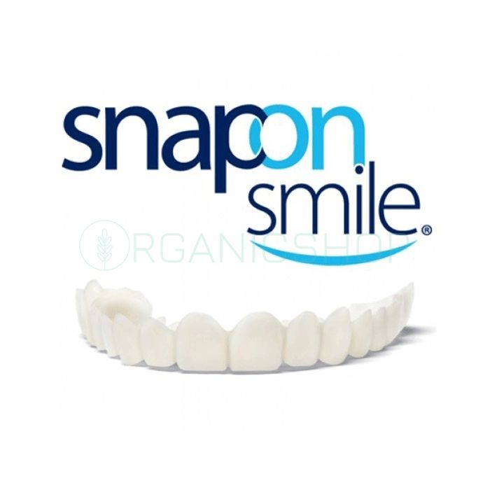 Snap-On Smile ⏤ veneers